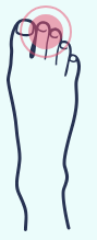 A drawing of a foot with a pink circle around it.
