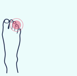 A drawing of a foot with a red spot on the toe.