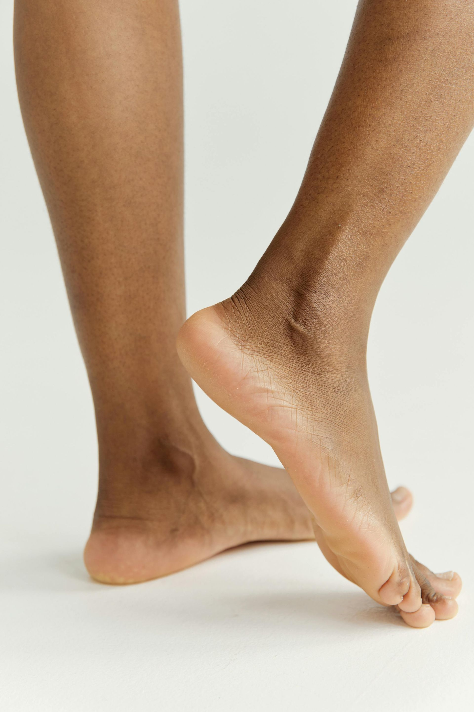 Diabetic Feet