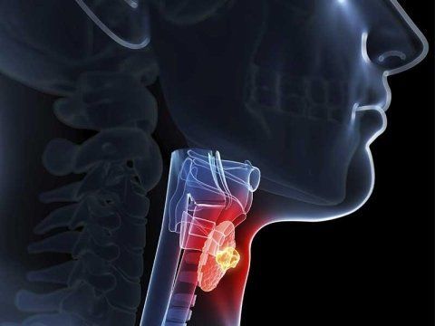 Patologie tumorali del collo