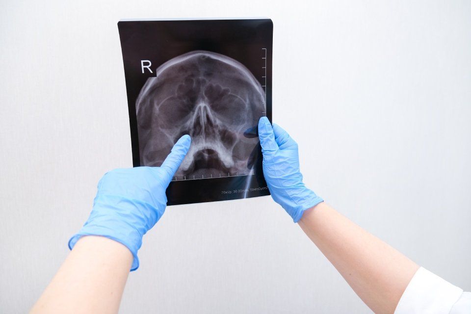 Analisi radiografia
