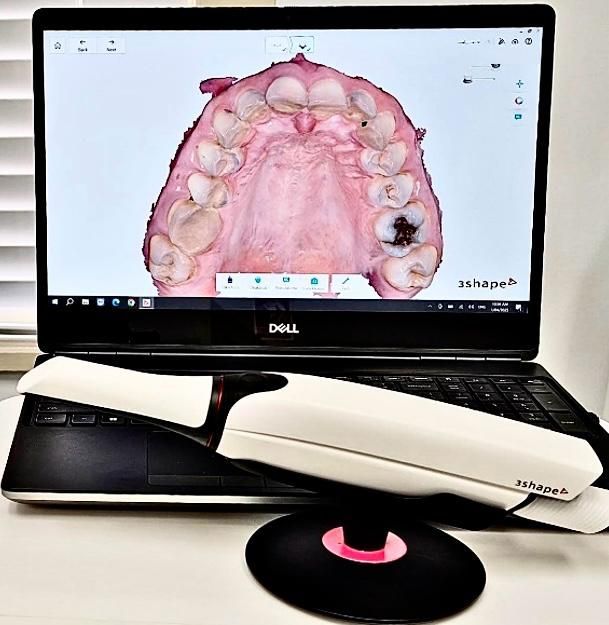 A laptop with a picture of a person 's teeth on the screen.