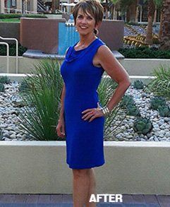 After Photo - Weight Loss Program in La Quinta, CA