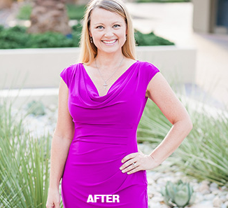 After Photo - Reach Your Weight Loss Goal in La Quinta, CA