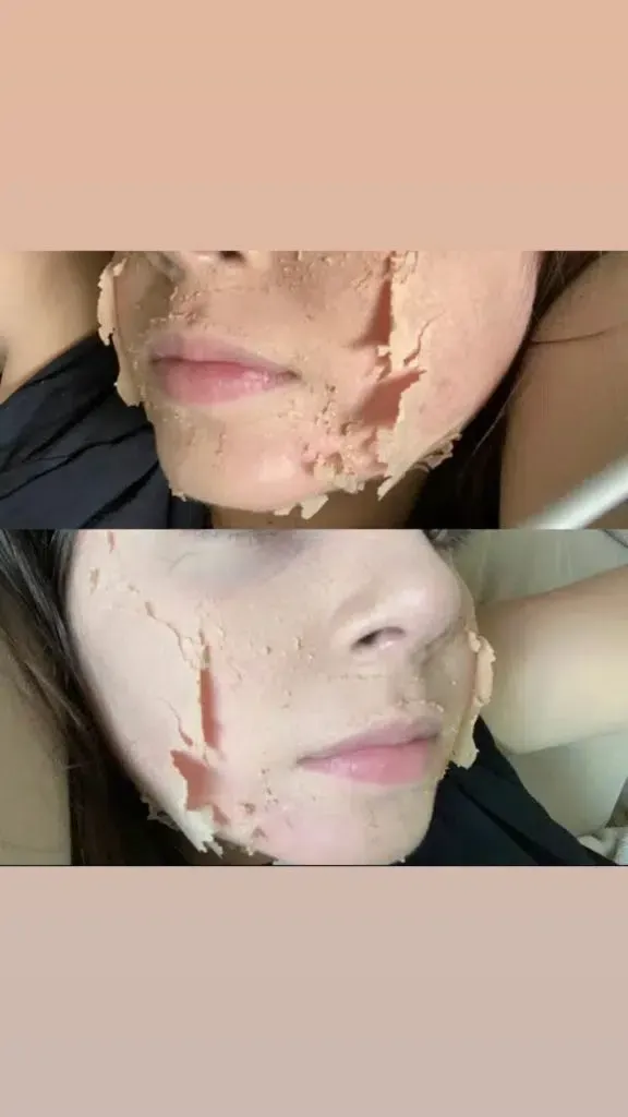 Ein Vorher-Nachher-Bild des Gesichts einer Frau mit einer Maske darauf.