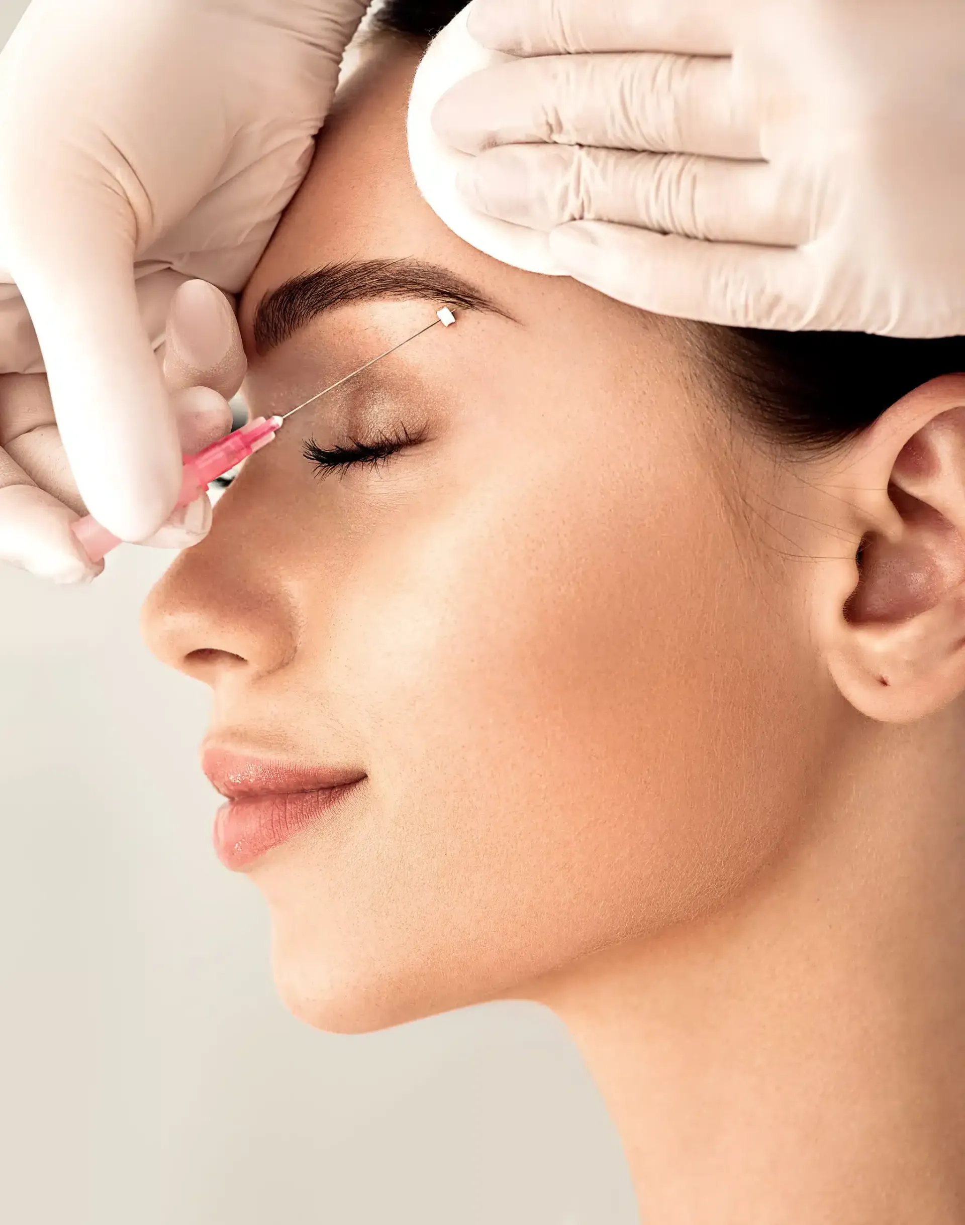 Eine Frau bekommt eine Botox-Injektion in die Stirn.