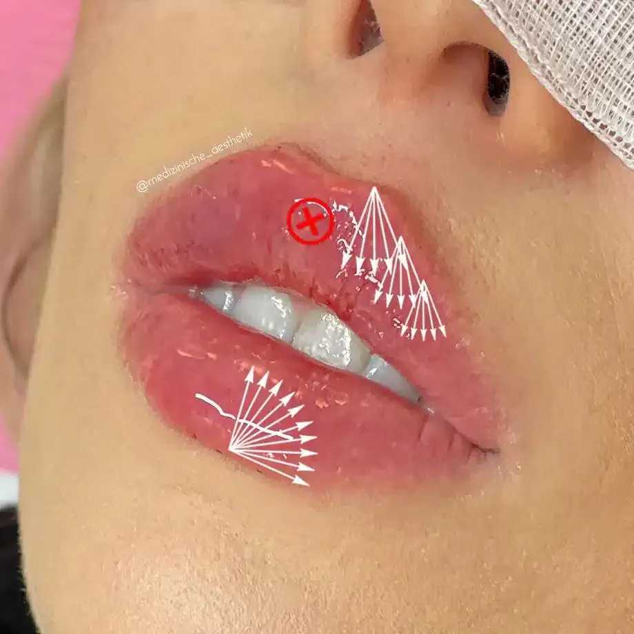 Eine Nahaufnahme der Lippen einer Frau mit einem Verband im Gesicht.