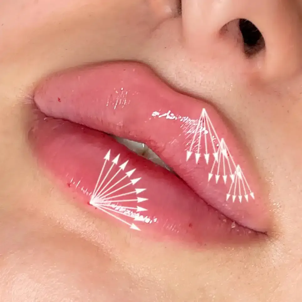 Eine Nahaufnahme der Lippen einer Frau mit darauf zeigenden Pfeilen.