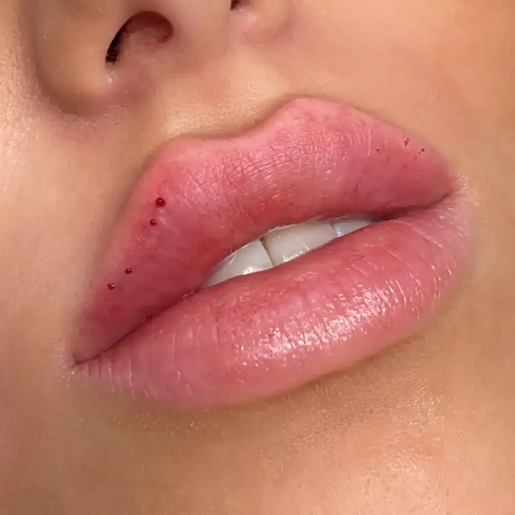 Eine Nahaufnahme der Lippen einer Frau mit roten Flecken darauf.