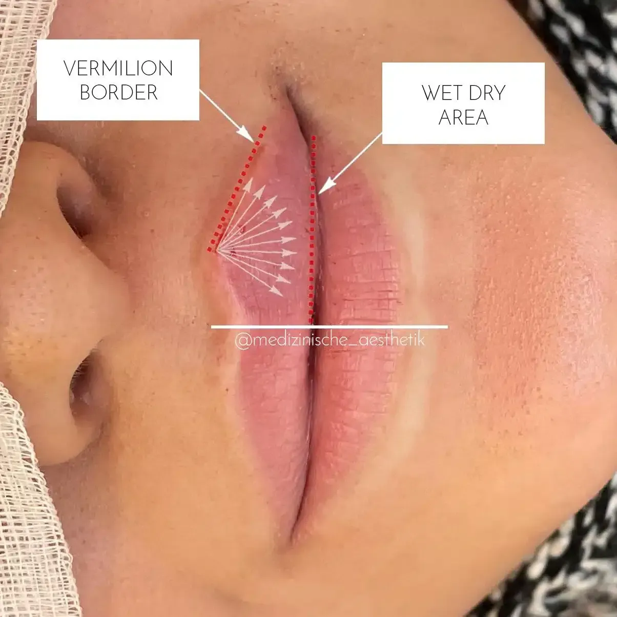 Eine Nahaufnahme des Gesichts einer Frau mit einem nassen trockenen Bereich beschriftet