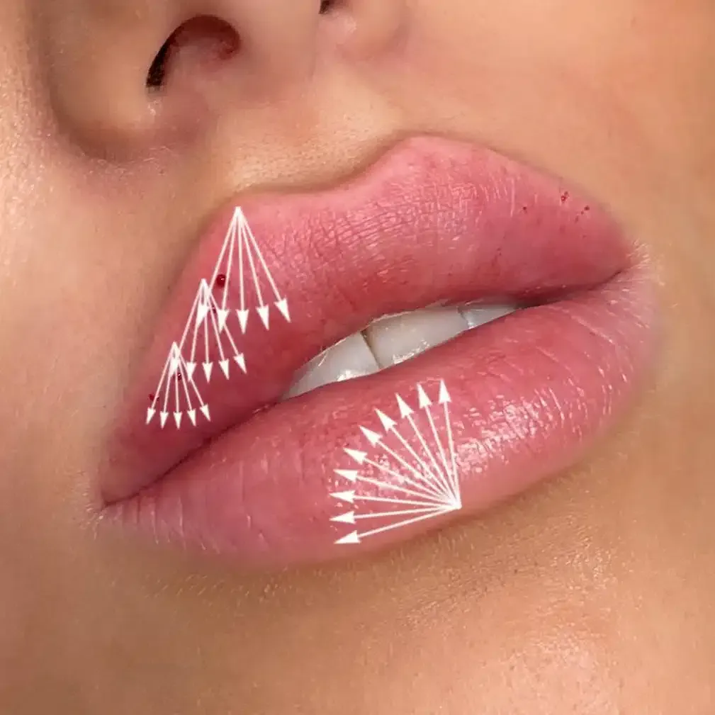 Eine Nahaufnahme der Lippen einer Frau mit darauf zeigenden Pfeilen.