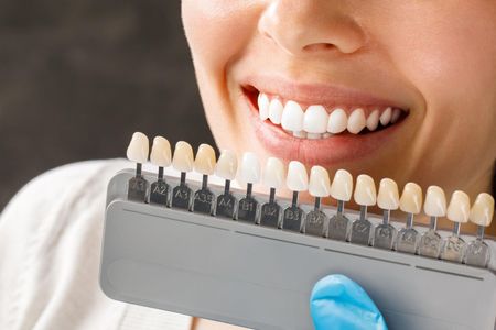 A dentist is holding a model of teeth in his hands.
