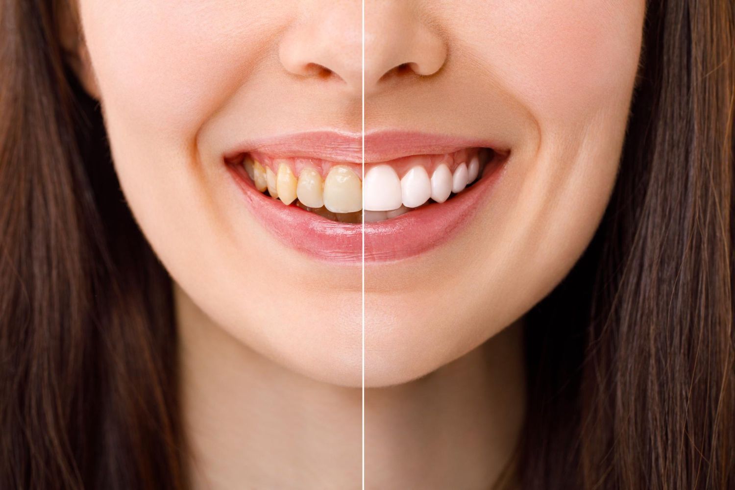 A close up of a woman 's smile with white teeth and pink lipstick.