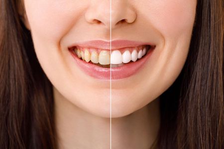A close up of a woman 's smile with white teeth and pink lipstick.