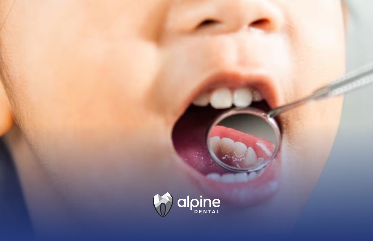 Child opening mouth during a dental checkup with mirror showing teeth, monitoring oral heath issues.