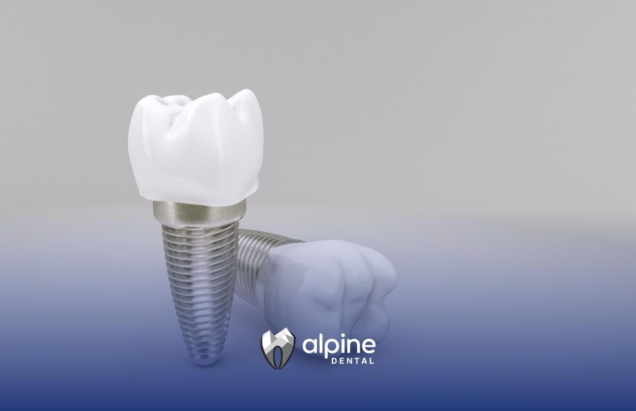 A dental implant is sitting next to a tooth on a table.