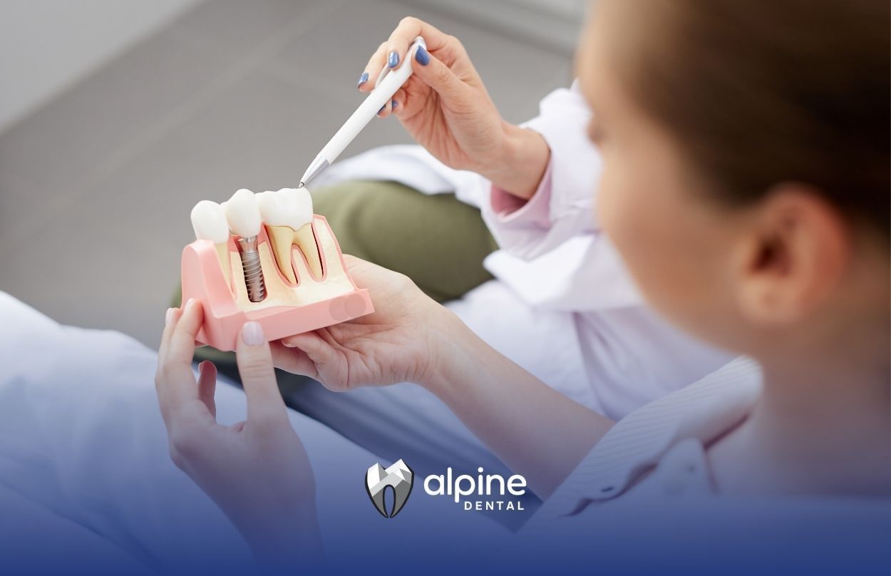 A dentist is holding a model of teeth with dental implants.