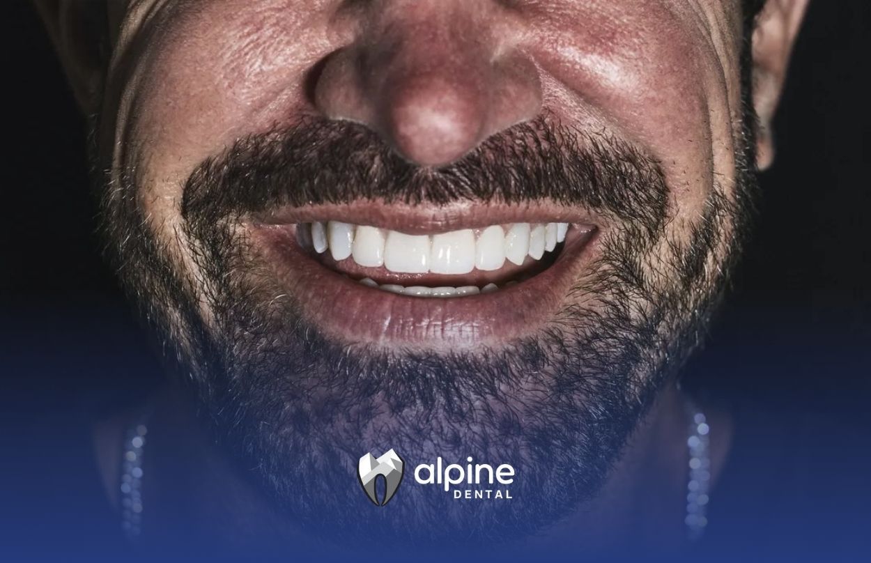 A man smiling, showing bright white dental veneers and a bearded face at a dental clinic in NJ.