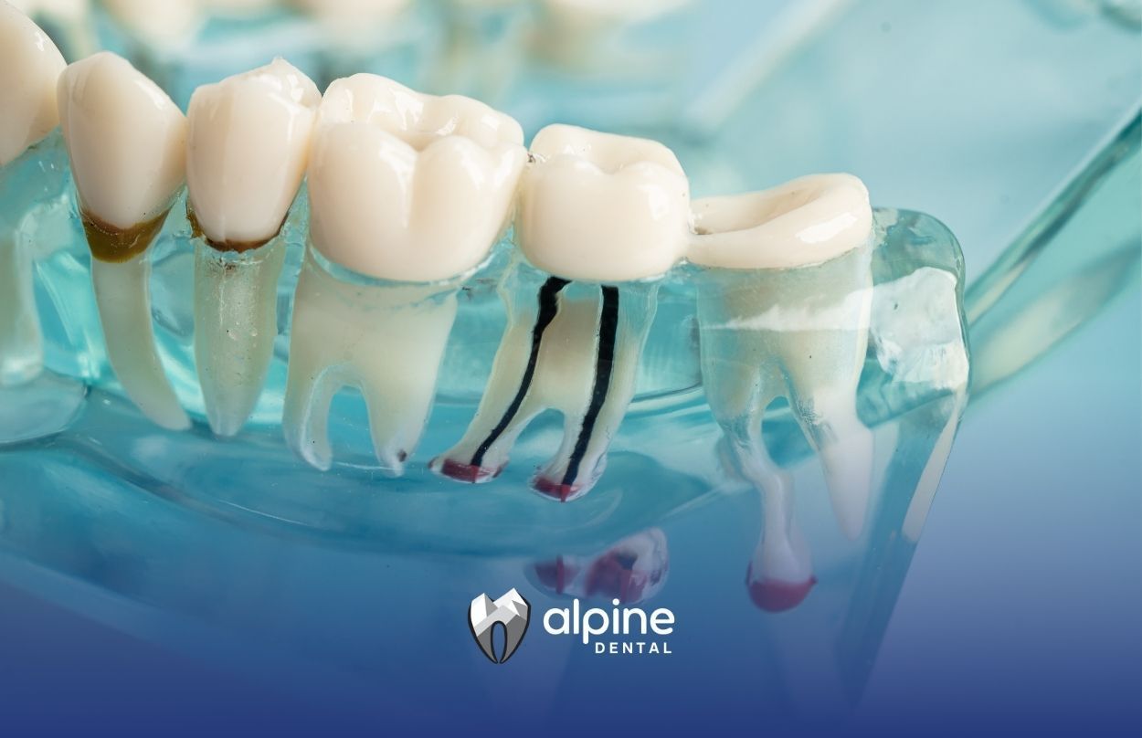 A close up of a model of a tooth with a root canal.