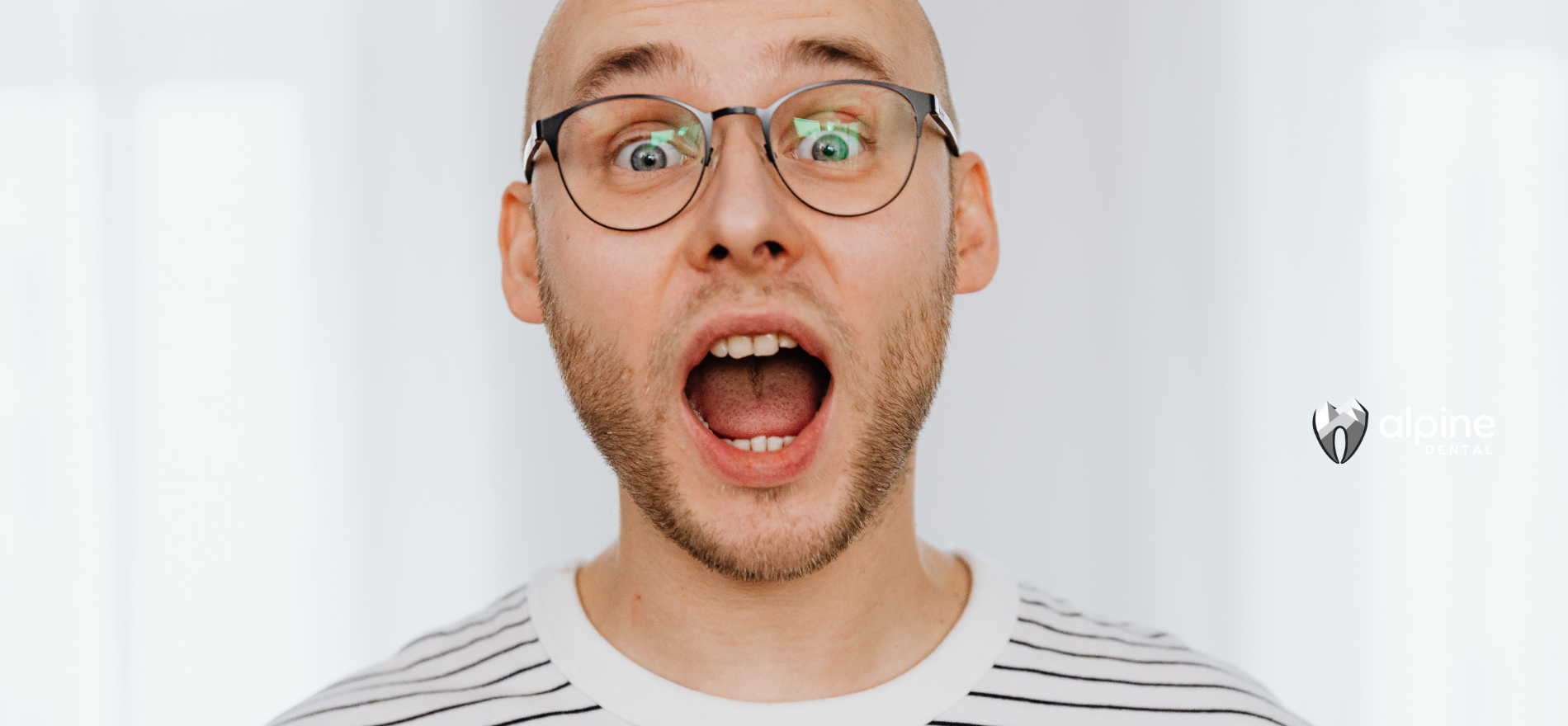 Bald man with glasses and mouth open in shock. White striped shirt, white background.