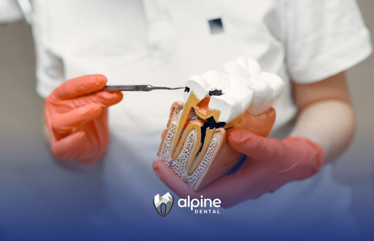 Dentist showing tooth decay model and giving patient options to extract tooth or do root canal.