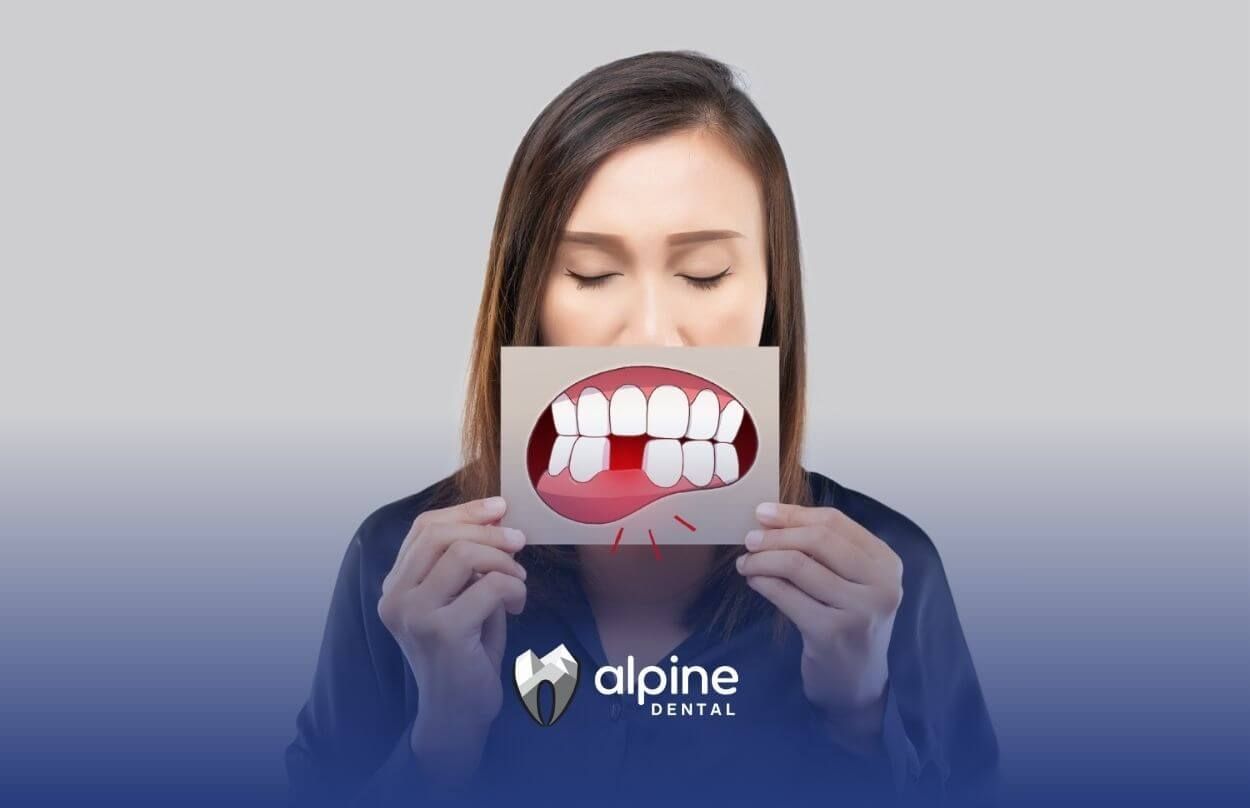 A woman is holding a picture of her teeth in front of her face.