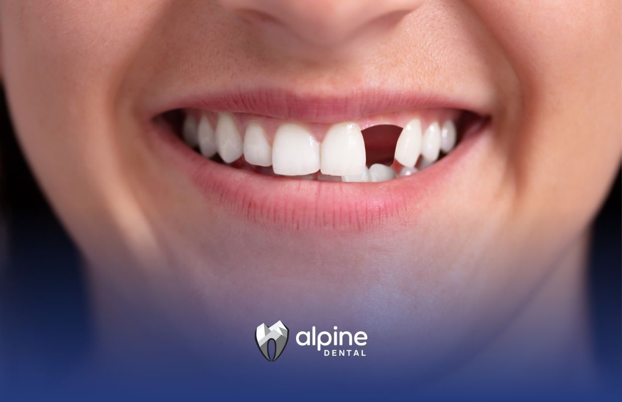 A close up of a woman 's mouth with a missing tooth.