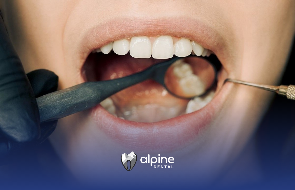 Dentist examining patient's teeth with a mirror and probe in a dental office.