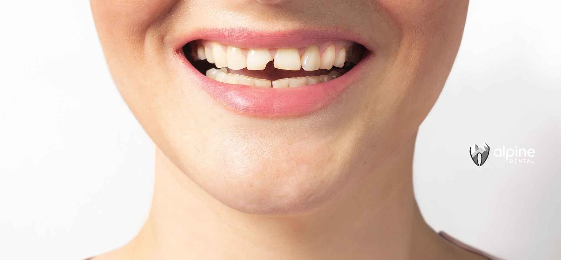 A close up of a woman 's mouth with a smile on her face.