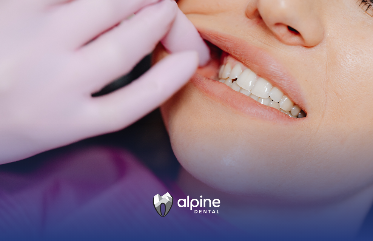 Dentist examining a patient's teeth. Close up shows a woman's mouth, gloved hands.