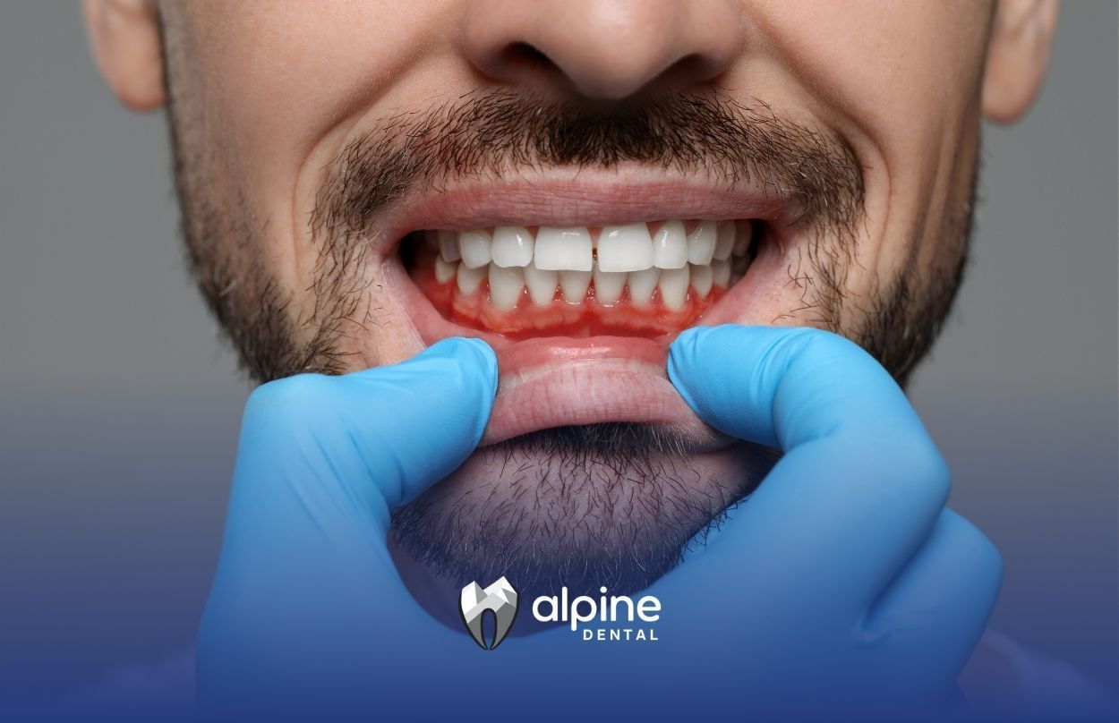 A man with a beard is getting his teeth examined by a dentist.