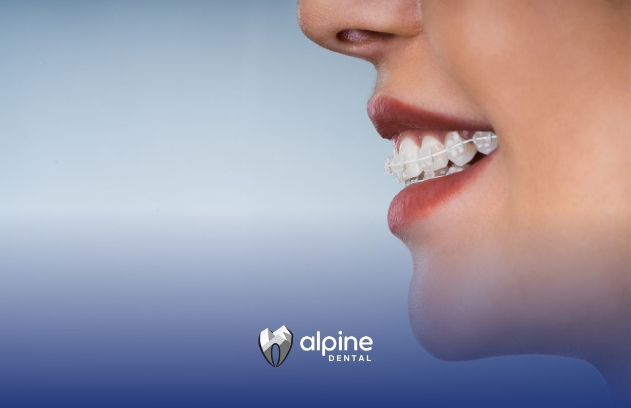 A close up of a woman 's mouth with braces on her teeth.
