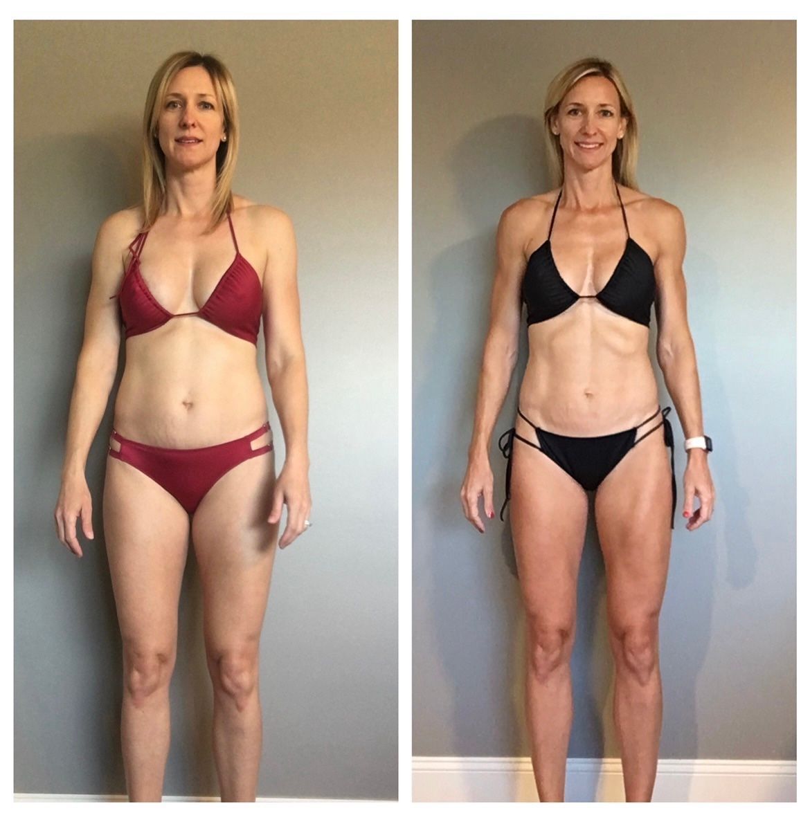 Jennifer front transformation - before and after