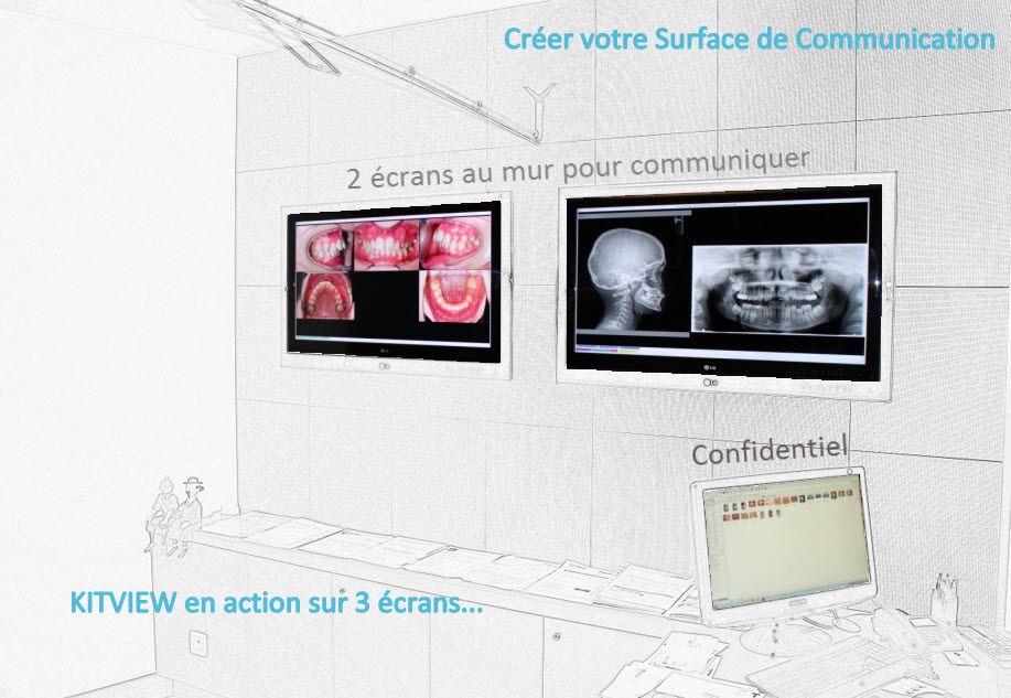 KITVIEW et ses écrans