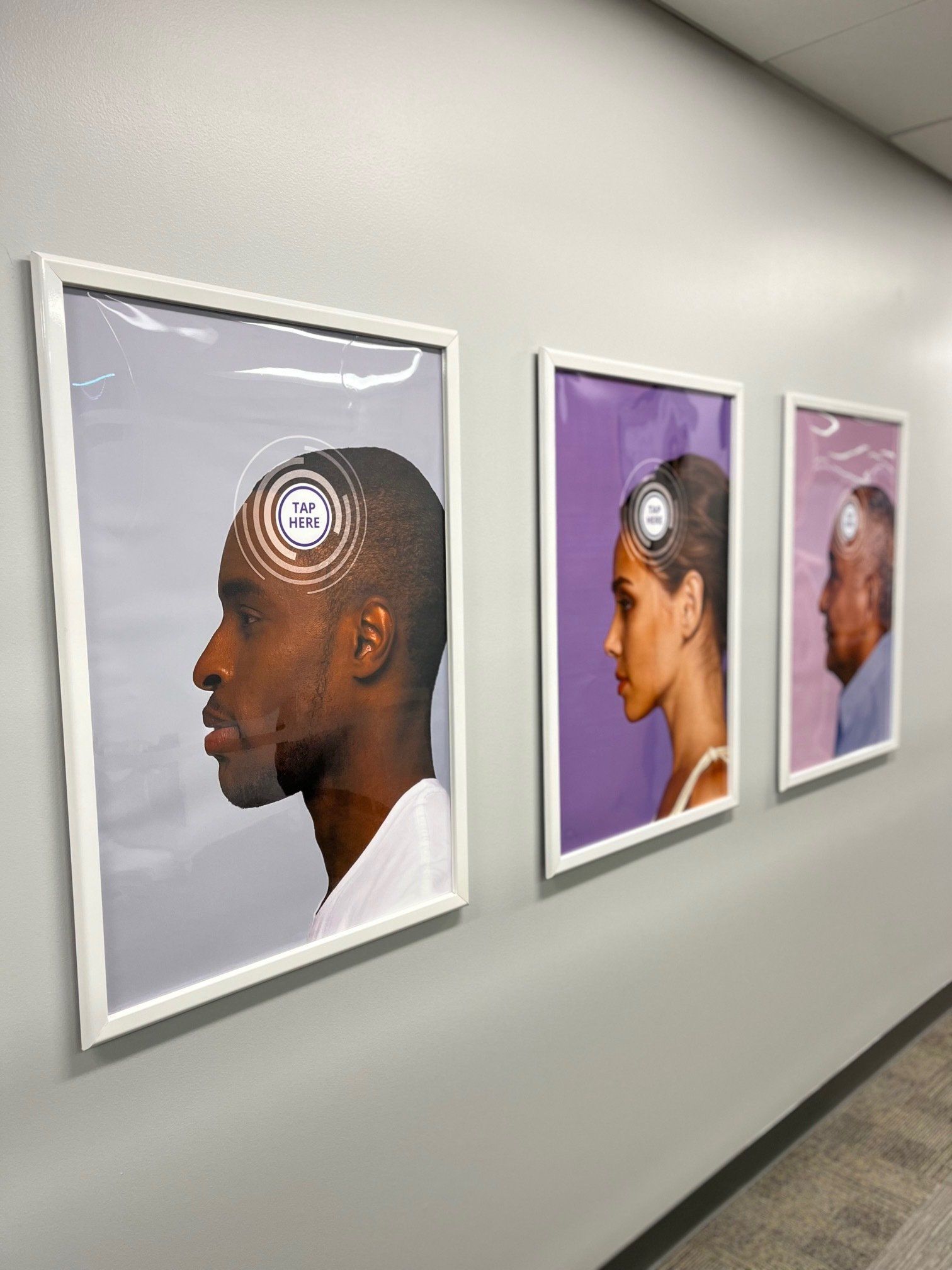 Three framed posters of profiles, each depicting a person with a circular brain scan.