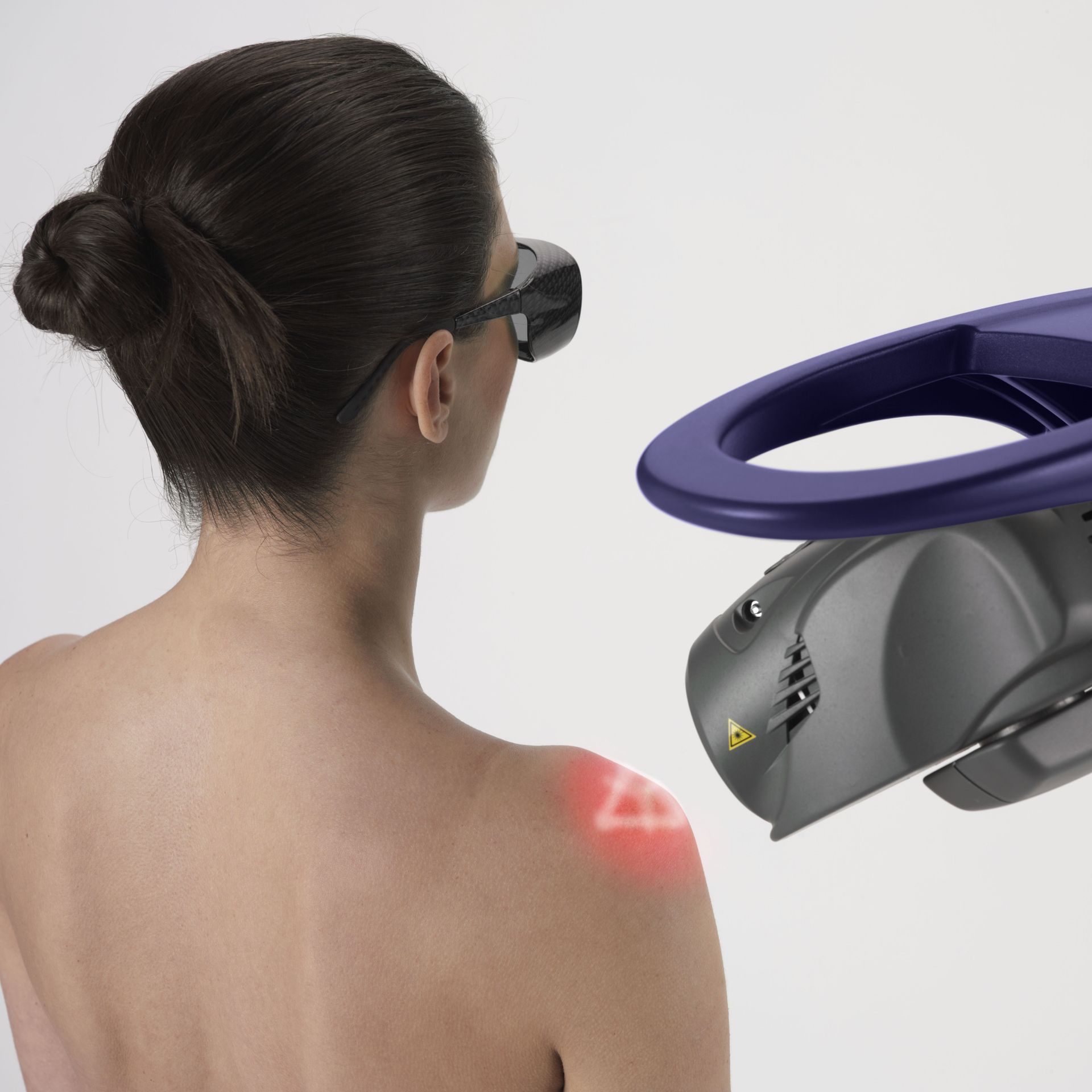 A woman is getting a laser treatment on her shoulder