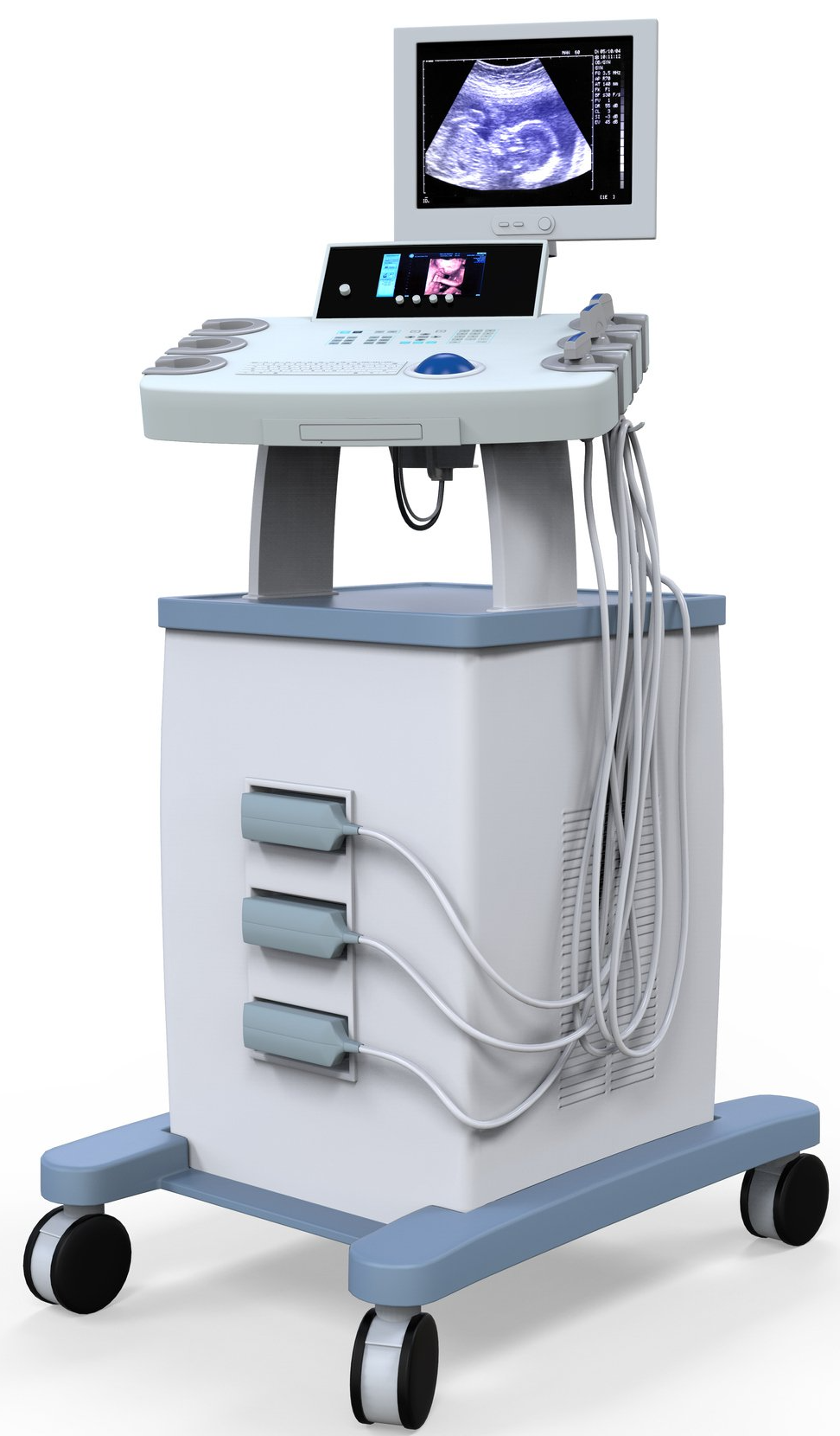 Medical Ultrasound Diagnostic Machine — Minneapolis, MN — Bester Bros Transfer & Storage Co
