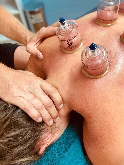Cupping Pin Point - Cupping In Yeppoon, QLD