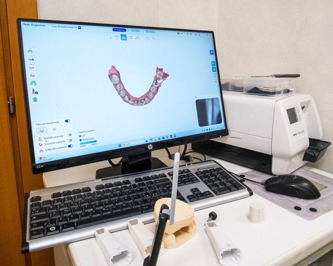 Consulenza per implantologia dentale