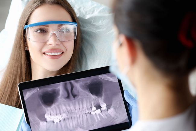 Consulenza per implantologia dentale