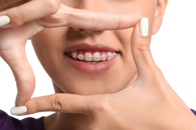 Consulenza per implantologia dentale