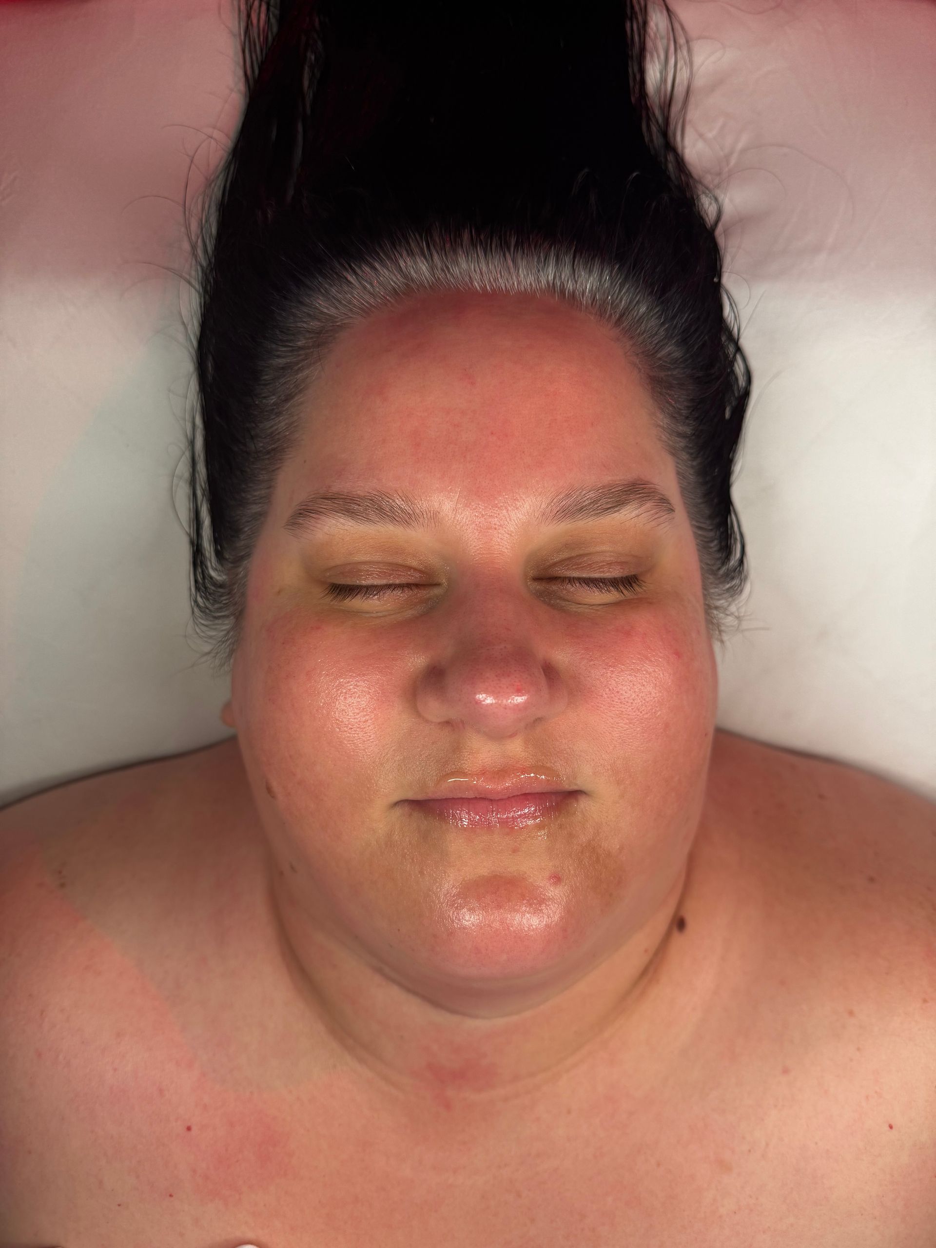 dermaplane facial