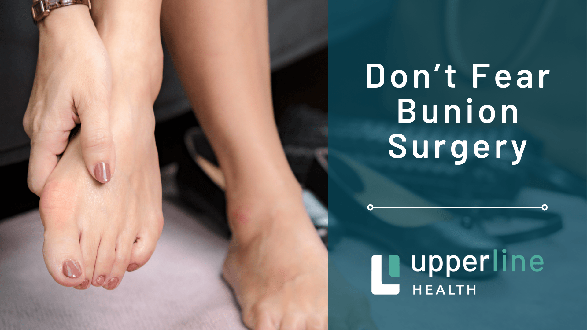 bunion surgery