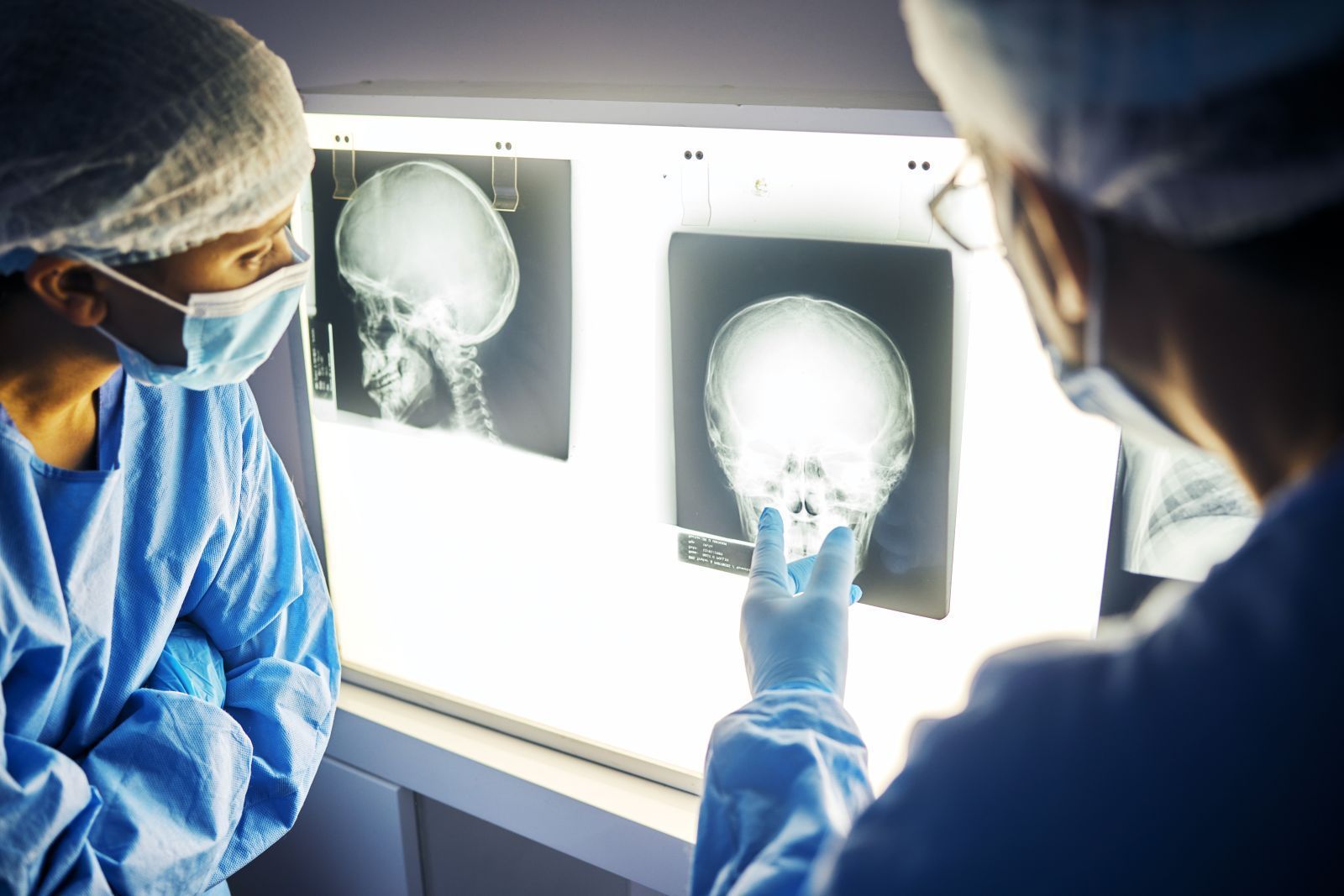 Two medical professionals in scrubs and masks examining skull X-rays on a light box.
