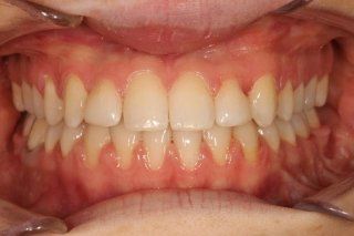 Ortodonzia e maxillo