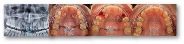 Ortodonzia chirurgica
