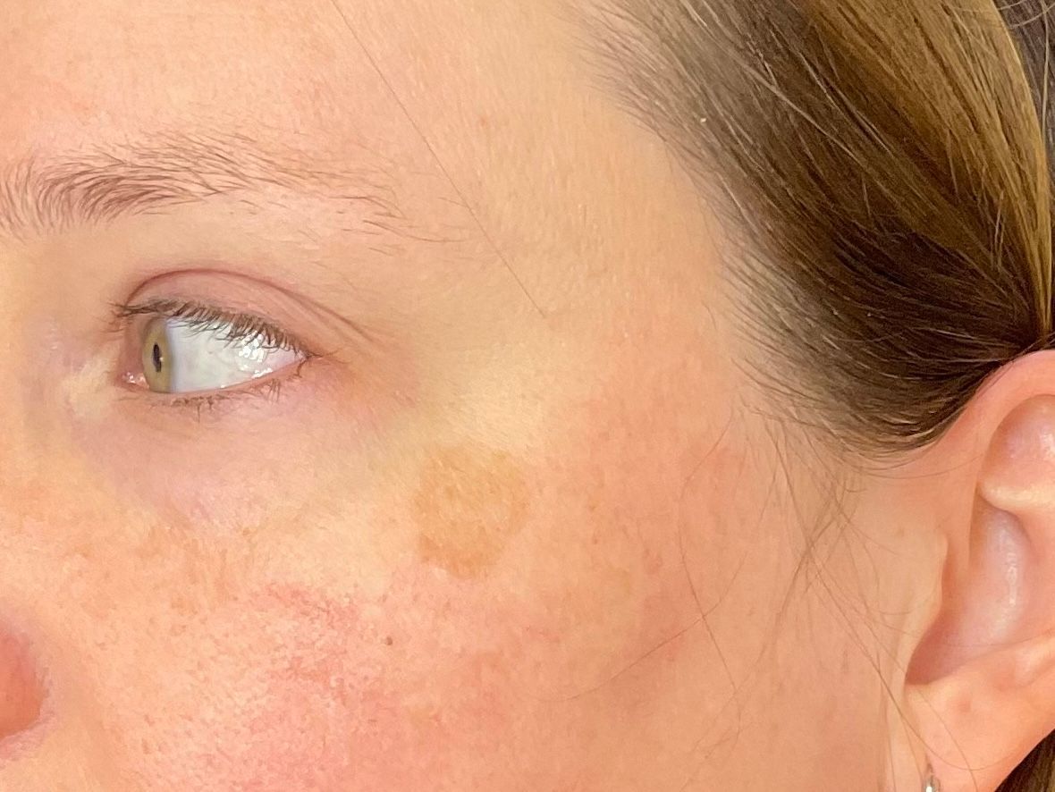A close up of a woman 's face with a white eye and ear.
