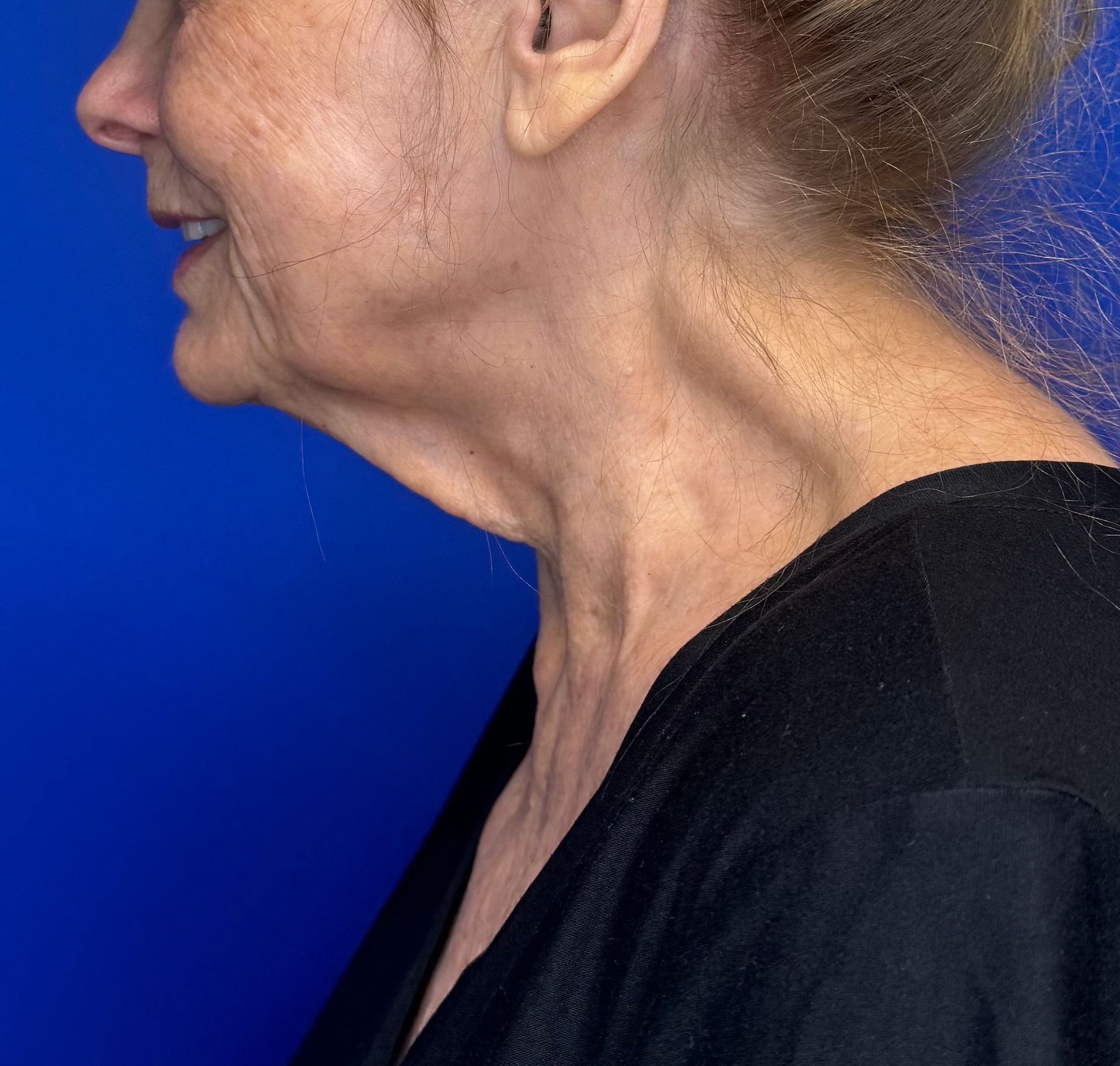 woman smiling from the side