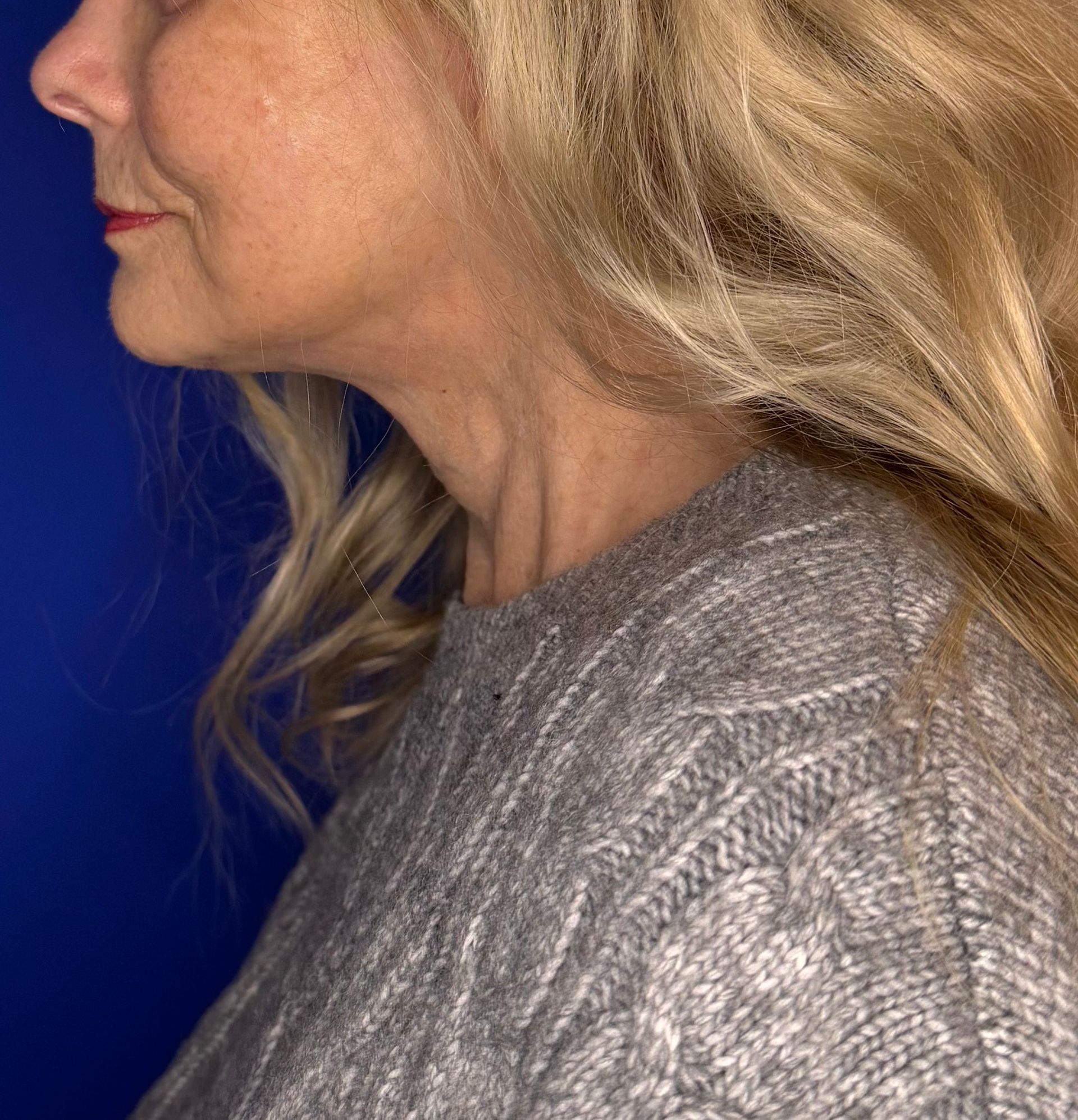 woman from the side