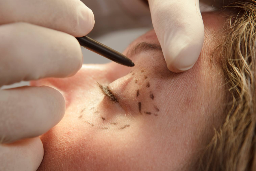 Plastic surgery in Clarksville, TN
